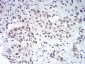 DDX5 Antibody